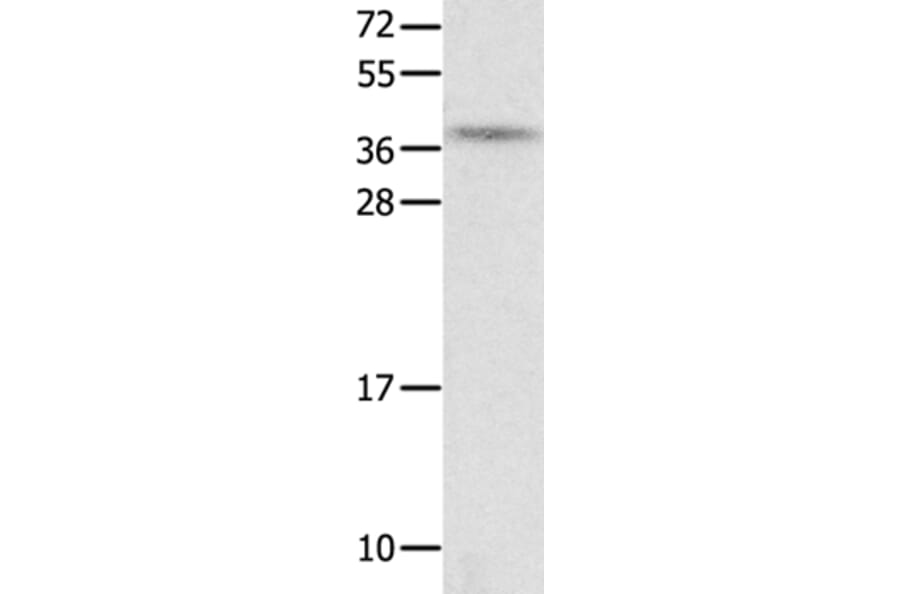 NTS Antibody from Signalway Antibody (35835) - Antibodies.com