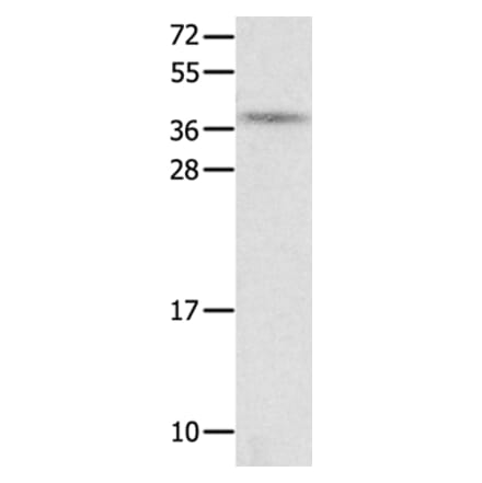 NTS Antibody from Signalway Antibody (35835) - Antibodies.com