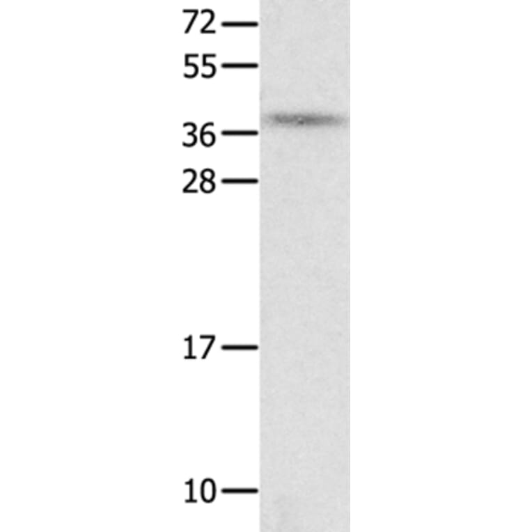 NTS Antibody from Signalway Antibody (35835) - Antibodies.com