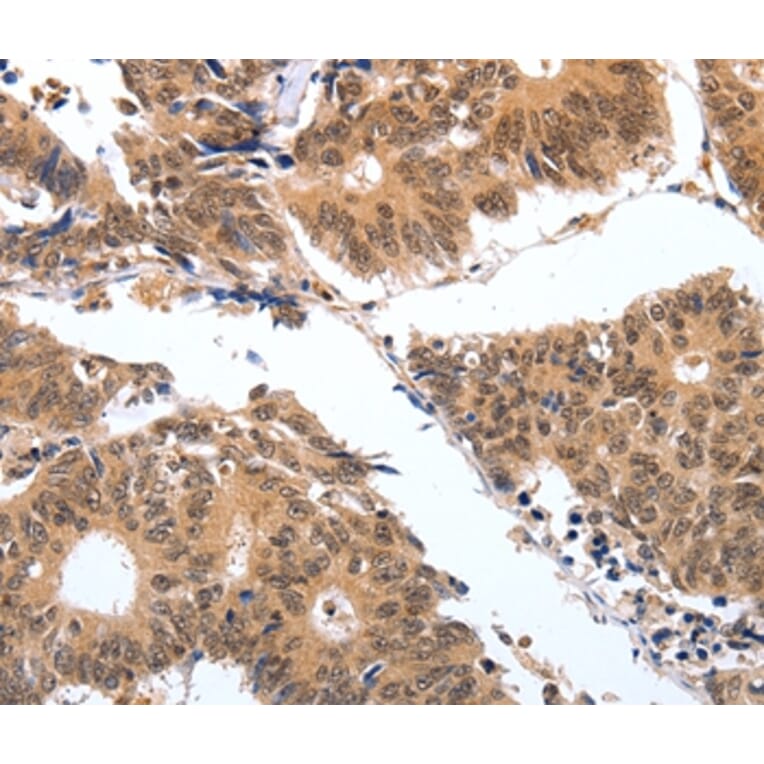 Immunohistochemistry - PGC Antibody from Signalway Antibody (35877) - Antibodies.com