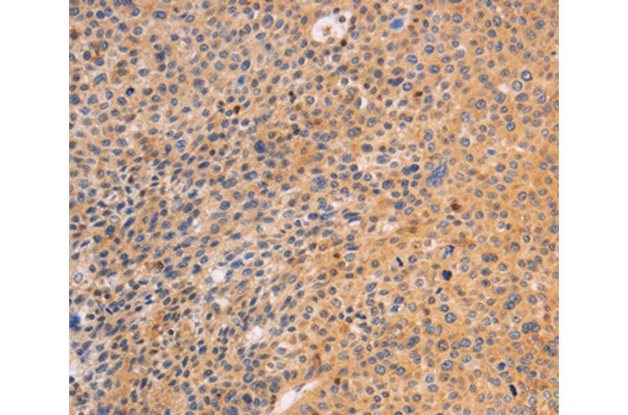 Immunohistochemistry - SRC Antibody from Signalway Antibody (35933) - Antibodies.com