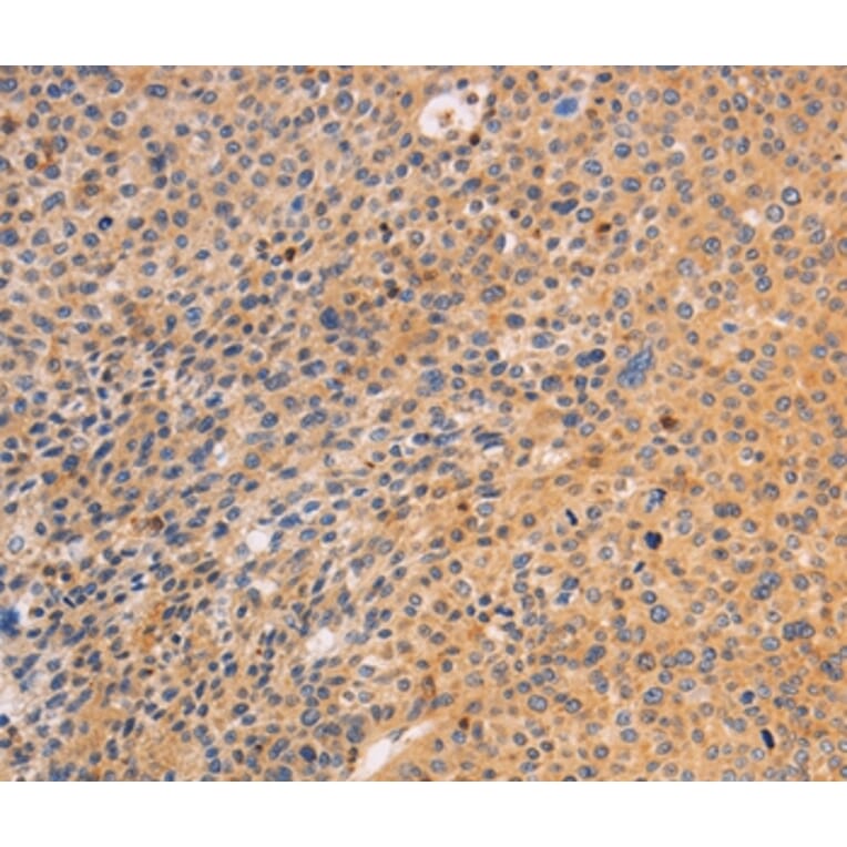 Immunohistochemistry - SRC Antibody from Signalway Antibody (35933) - Antibodies.com