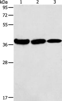 Anti-AGA Antibody (A39132) | Antibodies.com