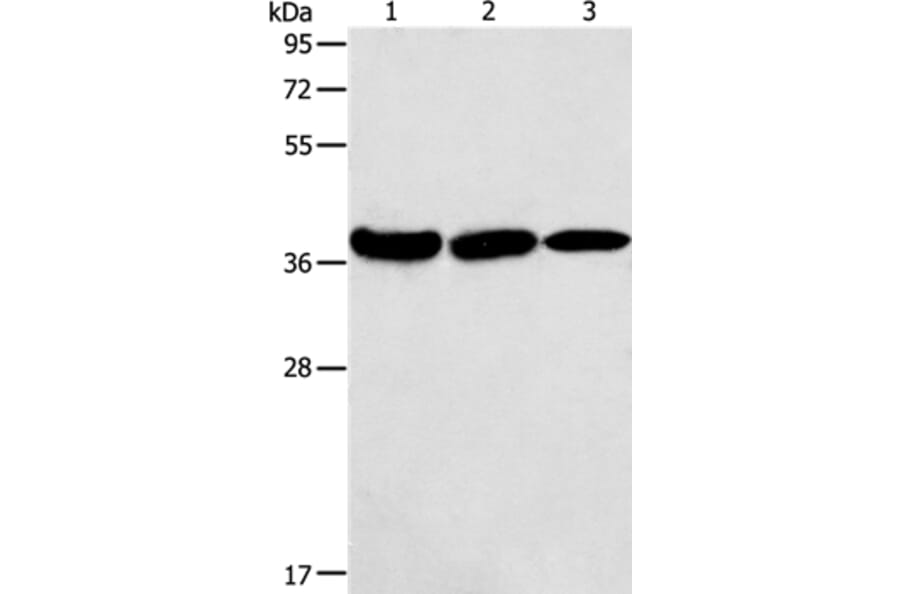 AGA Antibody from Signalway Antibody (36057) - Antibodies.com