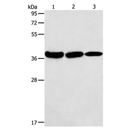 AGA Antibody from Signalway Antibody (36057) - Antibodies.com