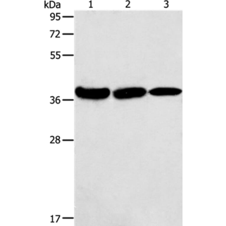 AGA Antibody from Signalway Antibody (36057) - Antibodies.com