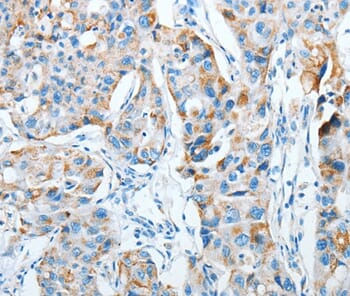 その他 aga Anti-AGA Antibody (A39132) | Antibodies.com