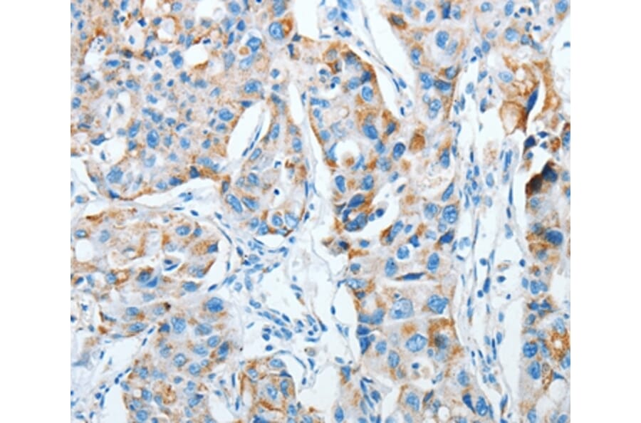 Immunohistochemistry - AGA Antibody from Signalway Antibody (36057) - Antibodies.com