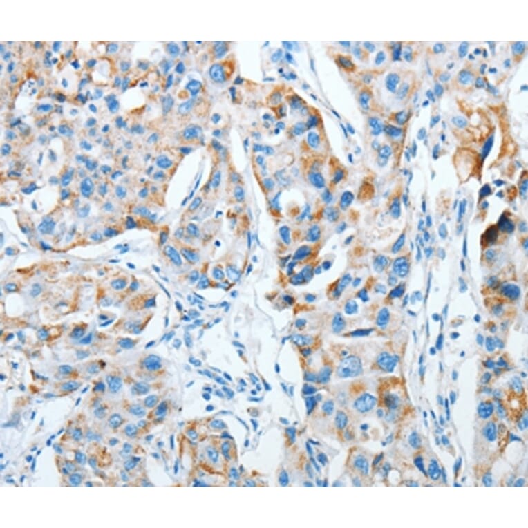 Immunohistochemistry - AGA Antibody from Signalway Antibody (36057) - Antibodies.com