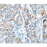 Immunohistochemistry - AGA Antibody from Signalway Antibody (36057) - Antibodies.com