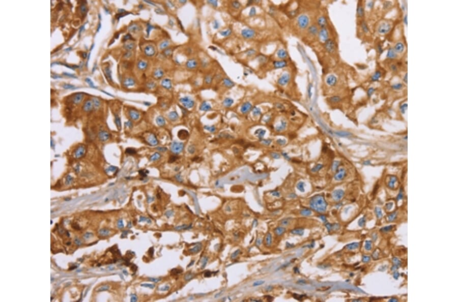 Immunohistochemistry - LTF Antibody from Signalway Antibody (36198) - Antibodies.com