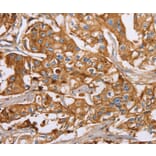 Immunohistochemistry - LTF Antibody from Signalway Antibody (36198) - Antibodies.com