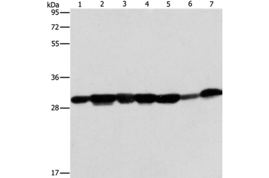 AK2 Antibody from Signalway Antibody (36210) - Antibodies.com