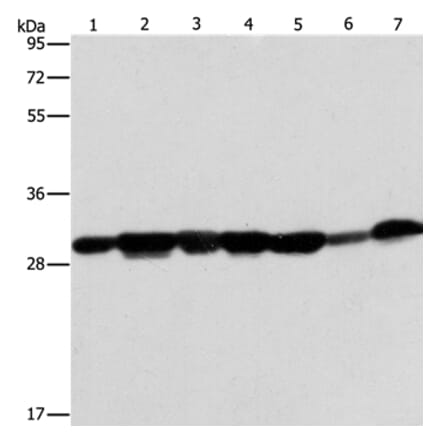 AK2 Antibody from Signalway Antibody (36210) - Antibodies.com