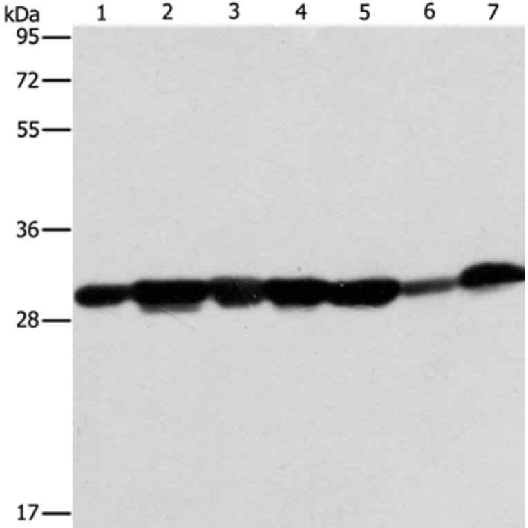 AK2 Antibody from Signalway Antibody (36210) - Antibodies.com