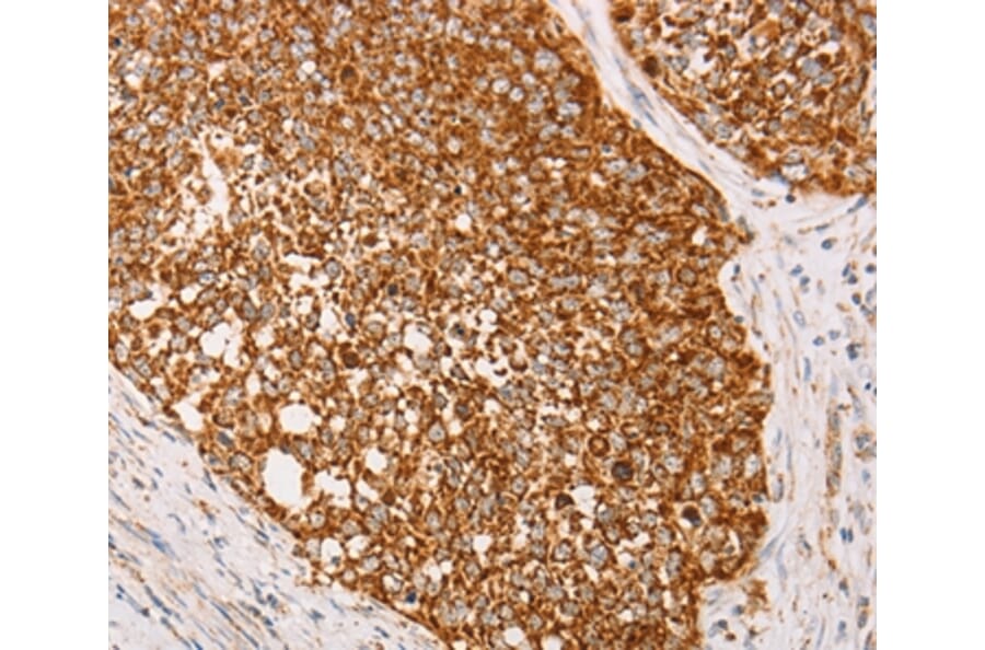 Immunohistochemistry - AK2 Antibody from Signalway Antibody (36210) - Antibodies.com