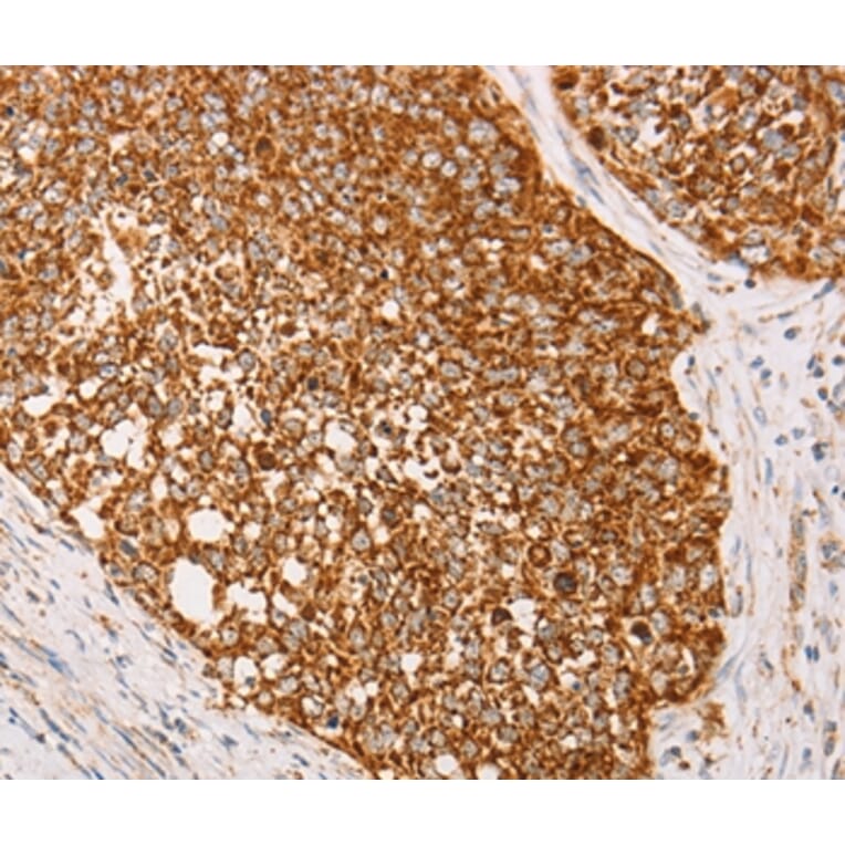 Immunohistochemistry - AK2 Antibody from Signalway Antibody (36210) - Antibodies.com