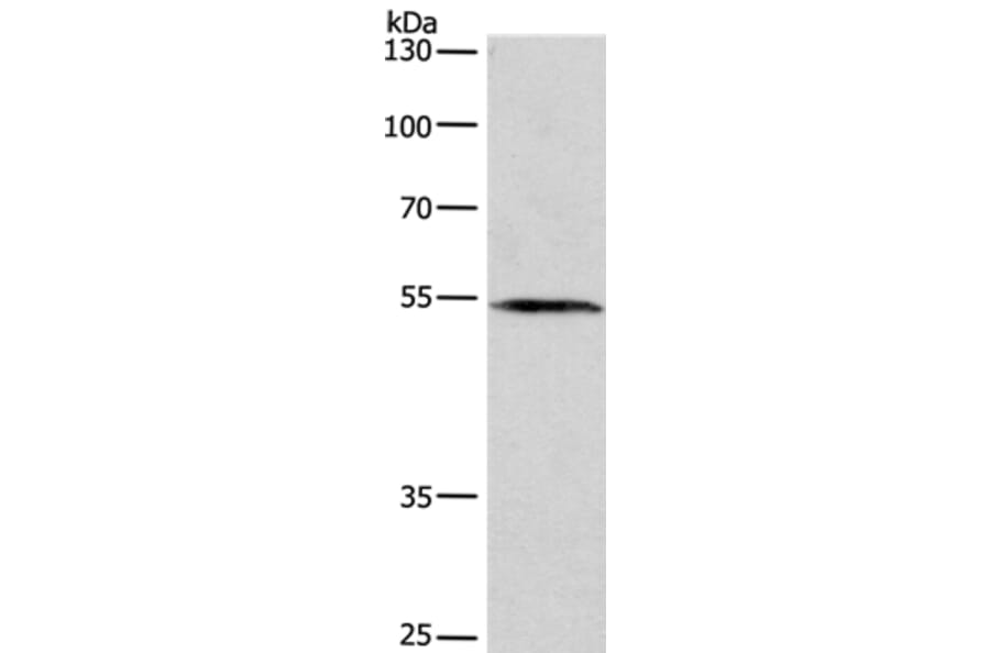 BLK Antibody from Signalway Antibody (36285) - Antibodies.com