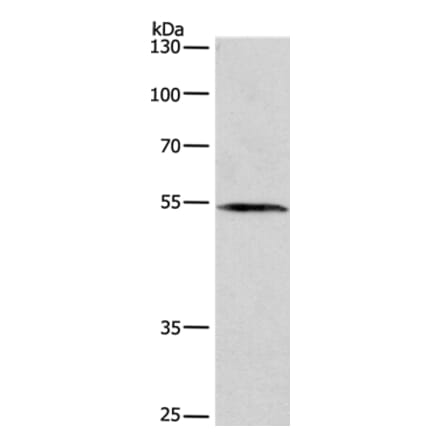 BLK Antibody from Signalway Antibody (36285) - Antibodies.com