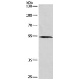 BLK Antibody from Signalway Antibody (36285) - Antibodies.com