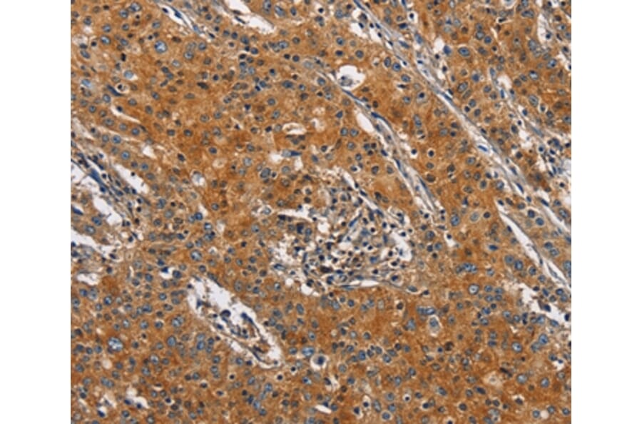 Immunohistochemistry - BLK Antibody from Signalway Antibody (36285) - Antibodies.com