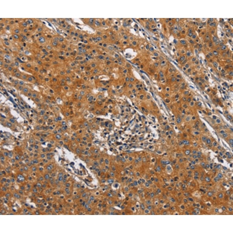 Immunohistochemistry - BLK Antibody from Signalway Antibody (36285) - Antibodies.com