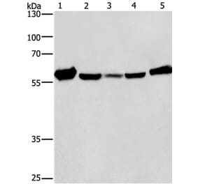 CAT Antibody from Signalway Antibody (36312) - Antibodies.com