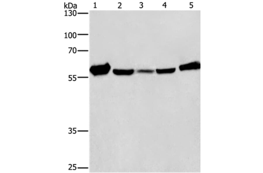 CAT Antibody from Signalway Antibody (36312) - Antibodies.com