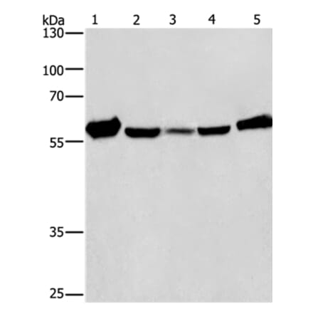 CAT Antibody from Signalway Antibody (36312) - Antibodies.com