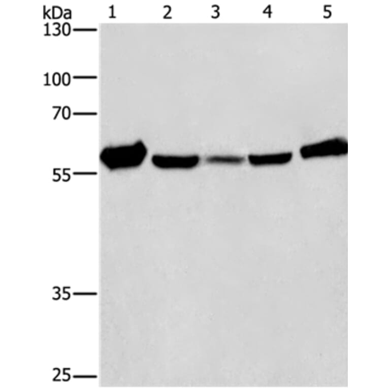 CAT Antibody from Signalway Antibody (36312) - Antibodies.com