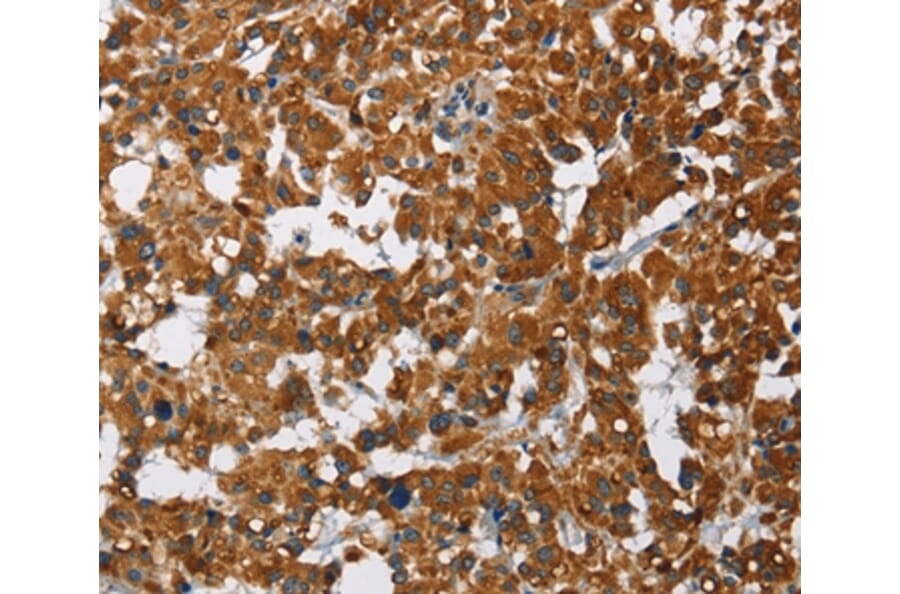 Immunohistochemistry - CAT Antibody from Signalway Antibody (36312) - Antibodies.com