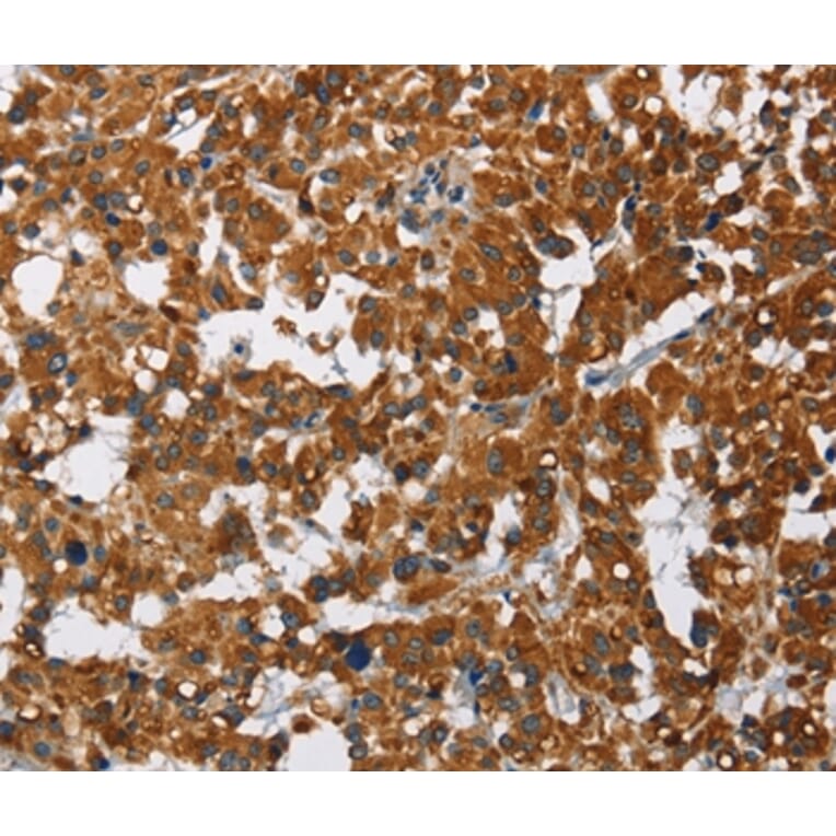 Immunohistochemistry - CAT Antibody from Signalway Antibody (36312) - Antibodies.com