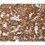 Immunohistochemistry - CAT Antibody from Signalway Antibody (36312) - Antibodies.com