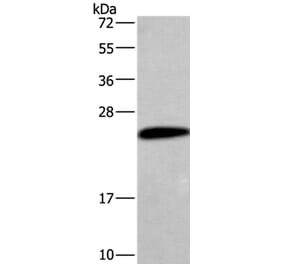 CGB Antibody from Signalway Antibody (36346) - Antibodies.com