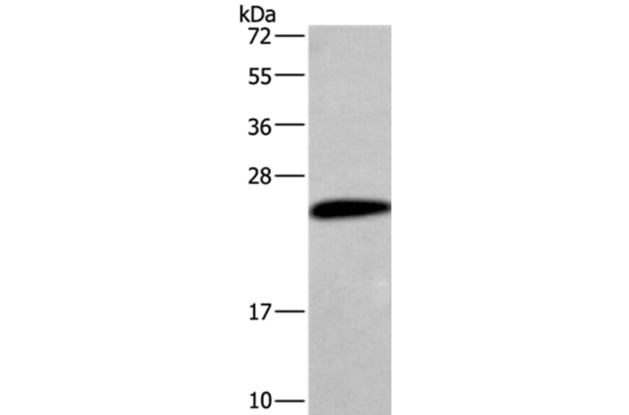 CGB Antibody from Signalway Antibody (36346) - Antibodies.com
