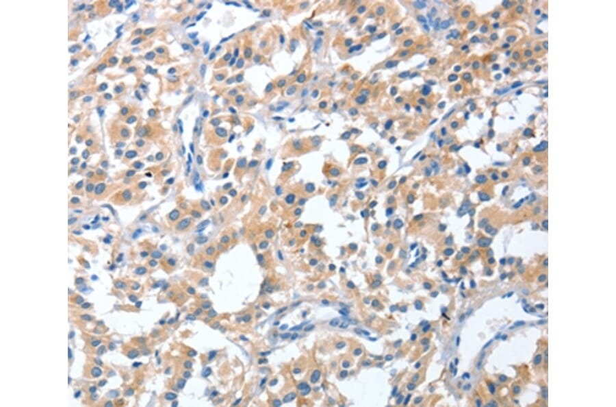 Immunohistochemistry - CGB Antibody from Signalway Antibody (36346) - Antibodies.com