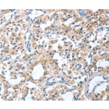Immunohistochemistry - CGB Antibody from Signalway Antibody (36346) - Antibodies.com