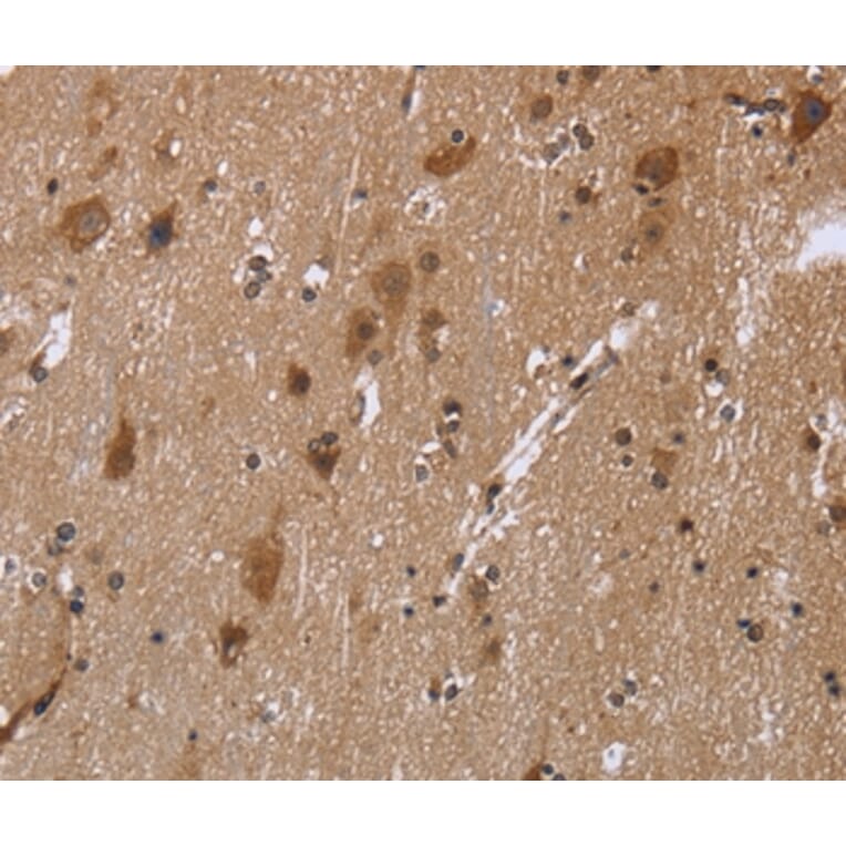 Immunohistochemistry - REL Antibody from Signalway Antibody (36369) - Antibodies.com