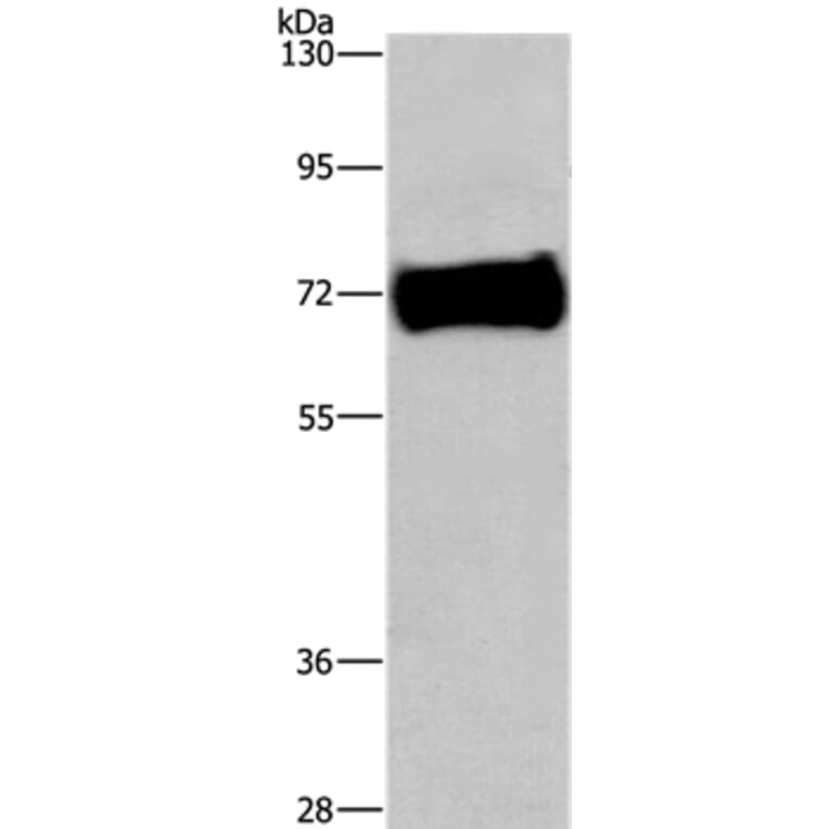 EZR Antibody from Signalway Antibody (36454) - Antibodies.com