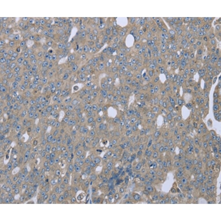 Immunohistochemistry - EZR Antibody from Signalway Antibody (36454) - Antibodies.com
