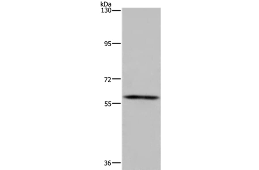 FTO Antibody from Signalway Antibody (36489) - Antibodies.com