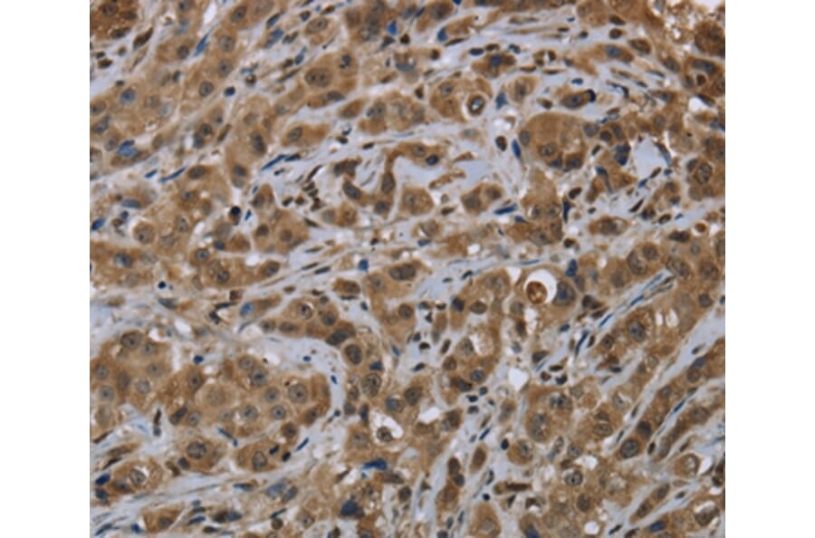 Immunohistochemistry - FTO Antibody from Signalway Antibody (36489) - Antibodies.com