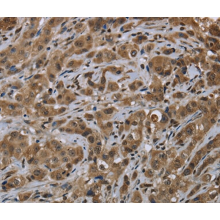 Immunohistochemistry - FTO Antibody from Signalway Antibody (36489) - Antibodies.com