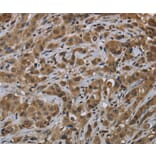 Immunohistochemistry - FTO Antibody from Signalway Antibody (36489) - Antibodies.com