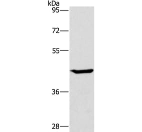 GCK Antibody from Signalway Antibody (36499) - Antibodies.com