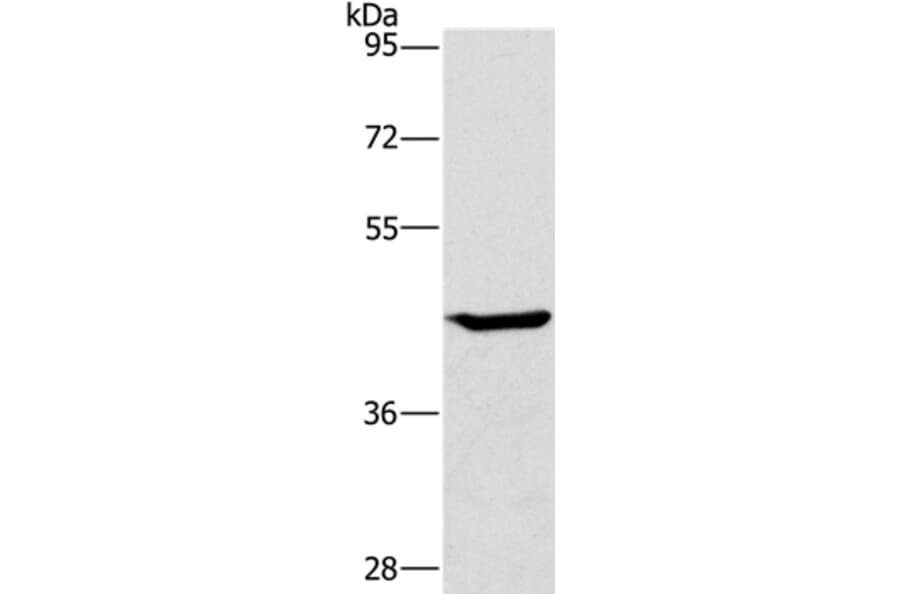 GCK Antibody from Signalway Antibody (36499) - Antibodies.com