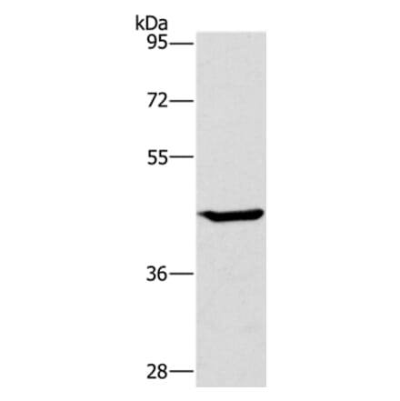 GCK Antibody from Signalway Antibody (36499) - Antibodies.com