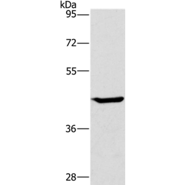 GCK Antibody from Signalway Antibody (36499) - Antibodies.com