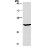 GCK Antibody from Signalway Antibody (36499) - Antibodies.com