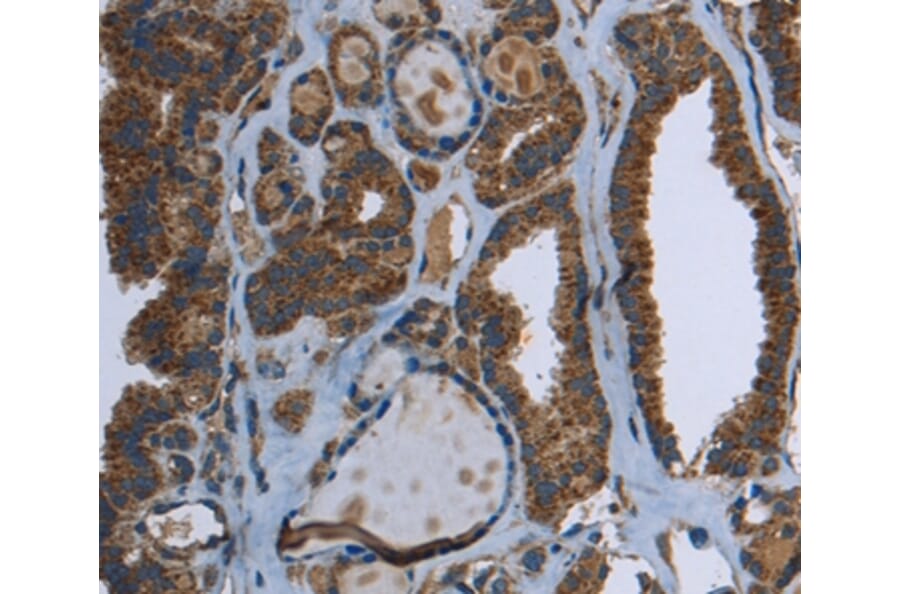 Immunohistochemistry - GCK Antibody from Signalway Antibody (36499) - Antibodies.com